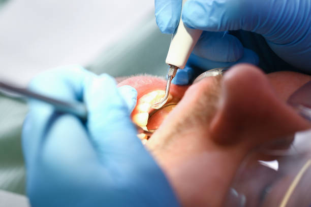 Best Weekend Emergency Dental Services in Morganfield, KY